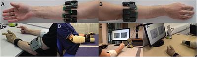 Effect of User Practice on Prosthetic Finger Control With an Intuitive Myoelectric Decoder